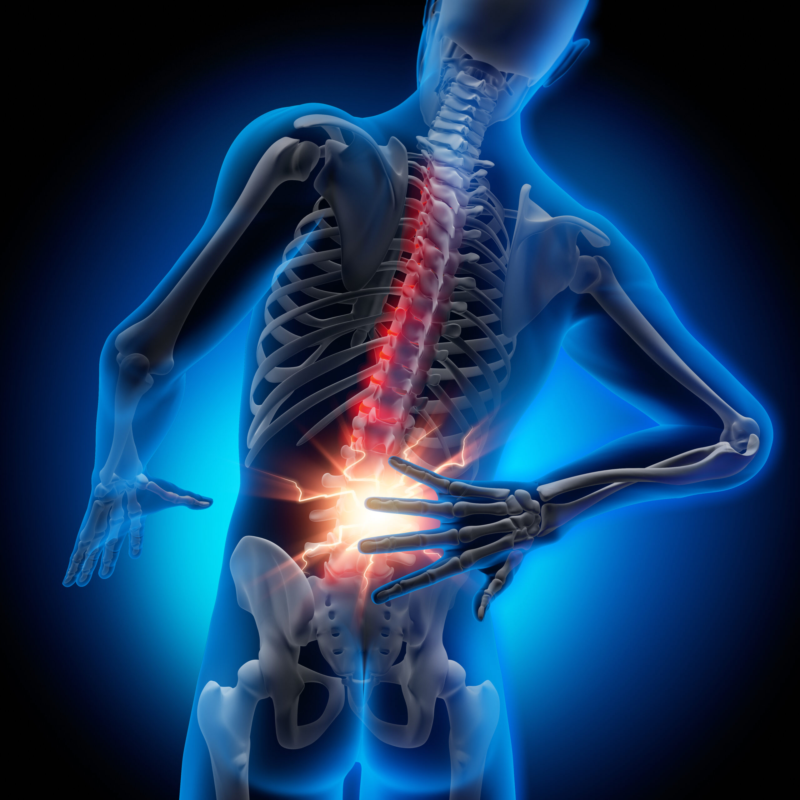 Spinalkanalstenose – Ursachen und Therapien